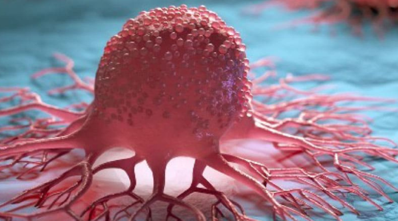 Solid Tumors Treatment in Mumbai by Dr Rohit Pai, best oncologist in Mumbai